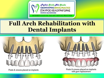 paphos smile art studio dental clinic